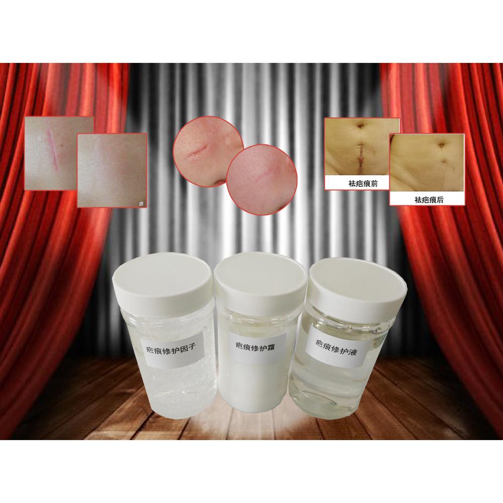 祛疤痕OEM代工
