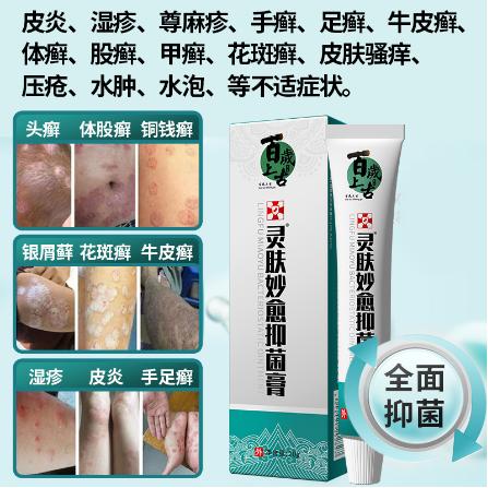 手足牛皮蘚護(hù)理止癢乳膏OEM代工