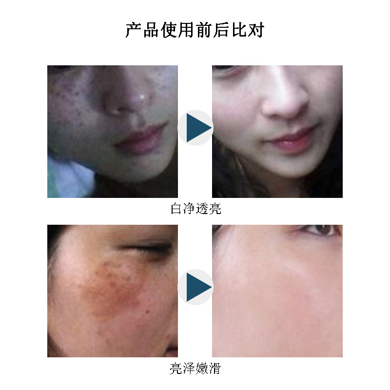 30ml巰基水提亮膚色改善暗沉分解色素抑制反黑祛痘排鉛汞臭臭水OEM代加工