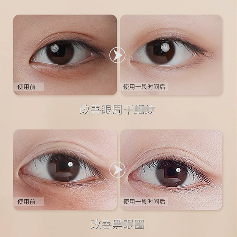 緩解眼疲勞眼酸家用冷敷護(hù)眼貼OEM代加工