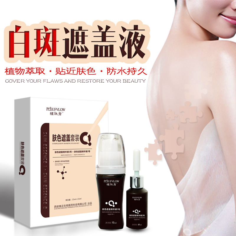 白斑遮蓋液防水防汗型本色靈白斑凈白癜外用護(hù)理液維正植膚秀直銷(xiāo)OEM代加工