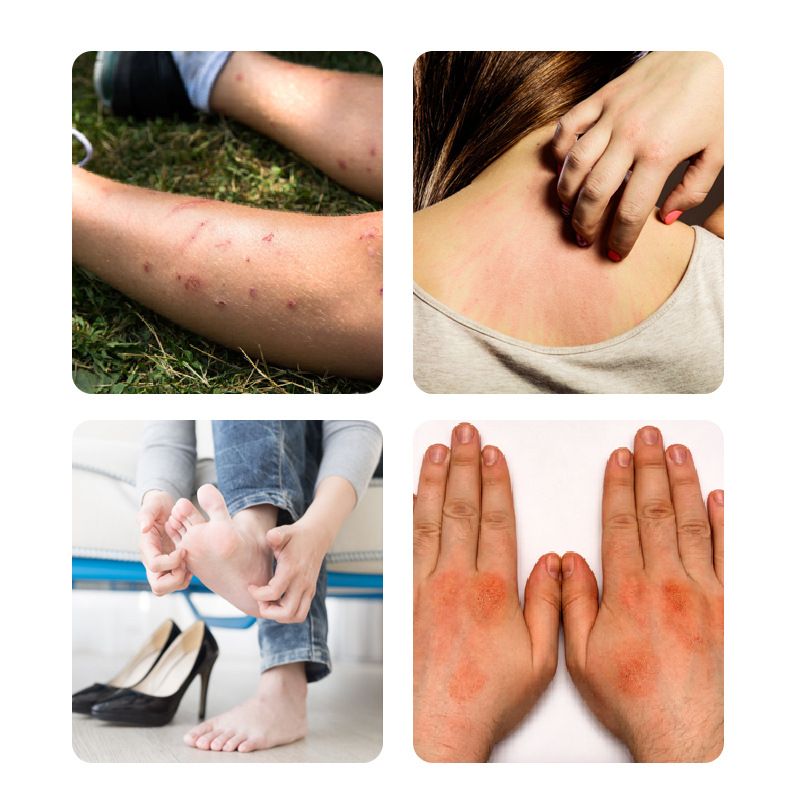 七毒皮癬康腳氣膏止癢噴劑去腳氣皮膚斷癢王乳膏批發(fā)跑江湖產(chǎn)品OEM代加工